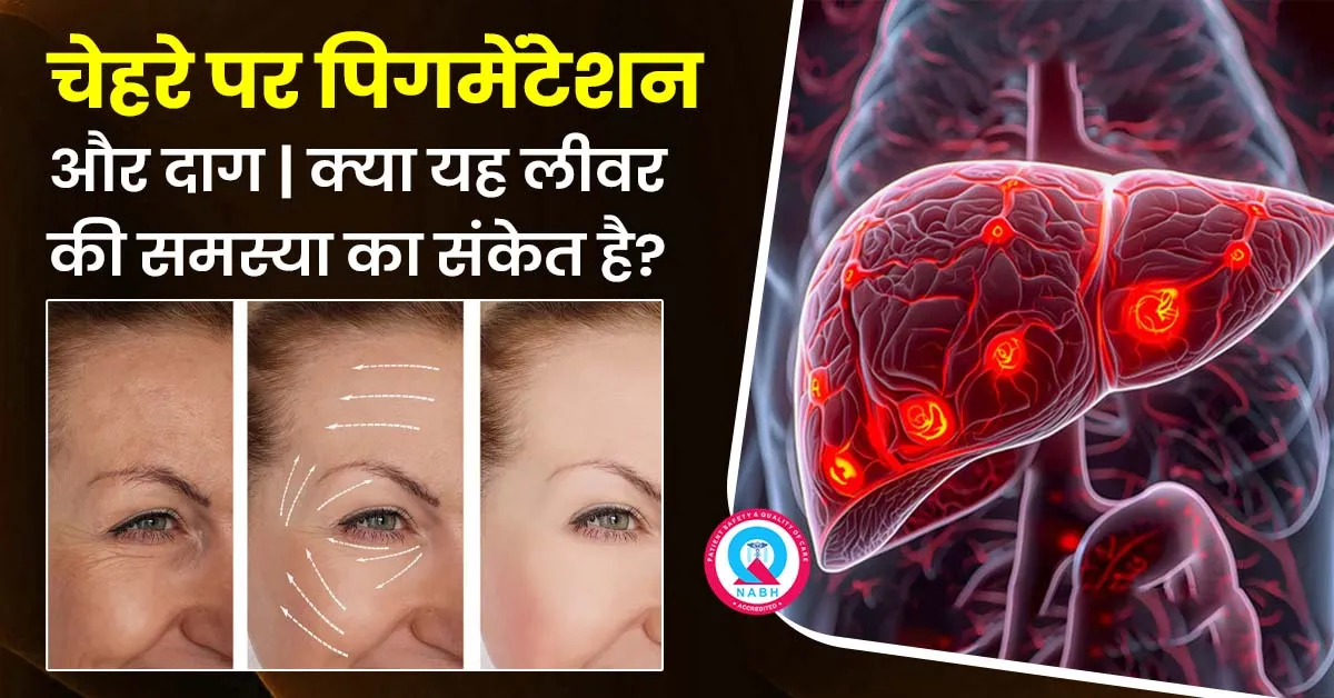 चेहरे-पर-पिगमेंटेशन-और-दाग-क्या-यह-लीवर-की-समस्या-है